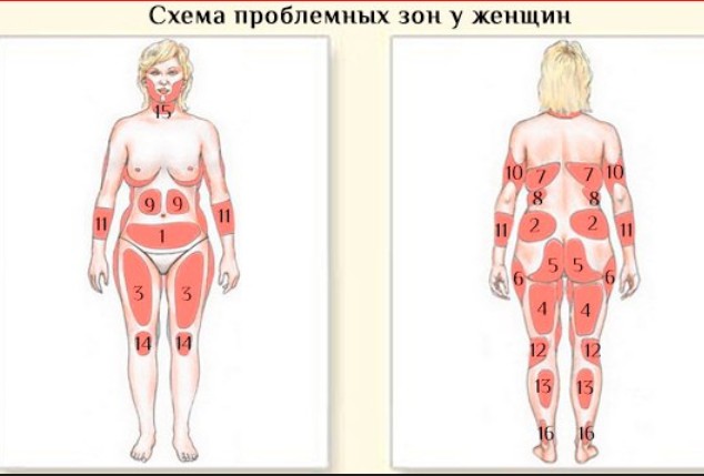 Проблемные зоны женской фигуры названия на рисунке