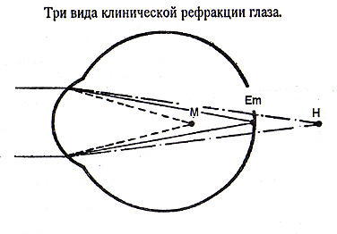 Эмметропическая рефракция. Три вида клинической рефракции глаза. Аномалии рефракции глаза. Физическая рефракция.